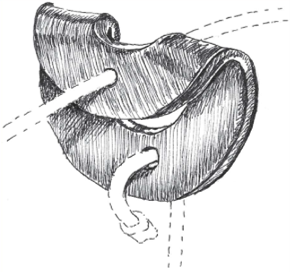 Diagram of a reverse-bend washer lock
